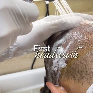 💦 First Head Wash After Hair Transplant? Follow These Steps!
Your grafts are still healing, so be g