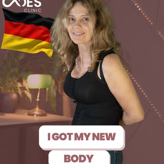 She flew from Germany to CADES Clinic. 🇩🇪
Just 8 days after her procedure no pain, full confidence