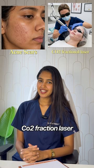 ✨ Different skin concerns need different treatments.

From acne scars and melasma to sagging skin an