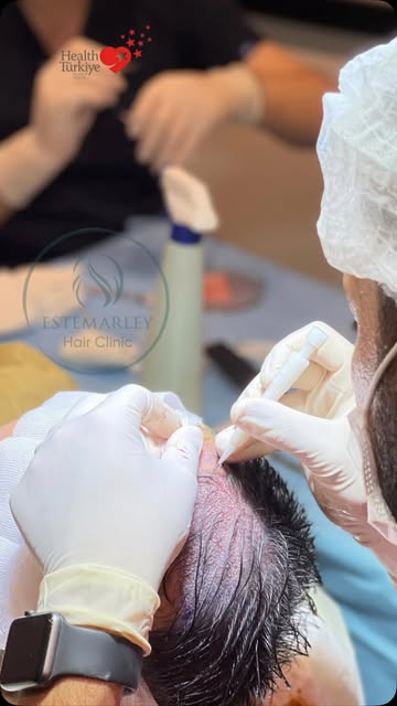 DHI Hair Transplantation 

Our posts are for informational purposes only.
Medical procedures are car