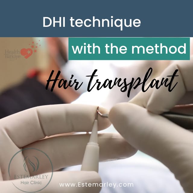 DHI Hair Transplant Technique 

A modern and precise approach to hair transplantation, designed for 