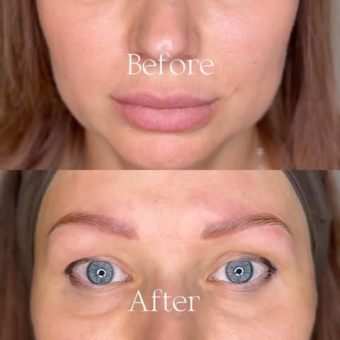 Hairstroke Hyper-Realism Brows for Alopecia

When natural brow hair is missing, the goal is not to c
