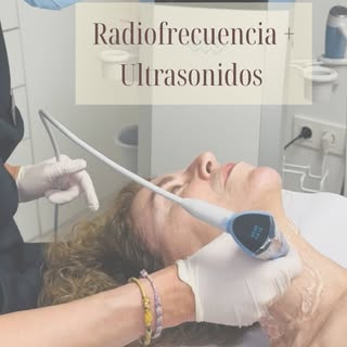 EXION TUS combina radiofrecuencia monopolar con ultrasonidos focalizados: mejora las arrugas, la fla