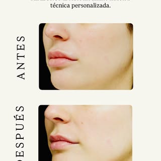 Tres de las especialidades que abordamos en @derclinicestetica, tres resultados reales 👆🏼

Siempre