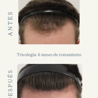 👆🏼Estos casos demuestran que la evidencia científica aplicada a la medicación oral/tópica es más q