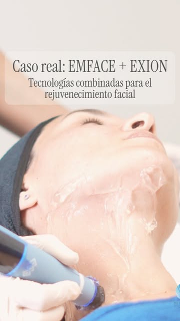 Hoy os mostramos un caso real en el que combinamos EMFACE y EXION para trabajar diferentes estructur