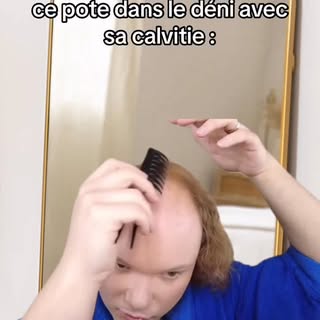 Tu savais que la carence en vitamine D peut aggraver la chute de cheveux ?

Mais spoiler : elle ne f