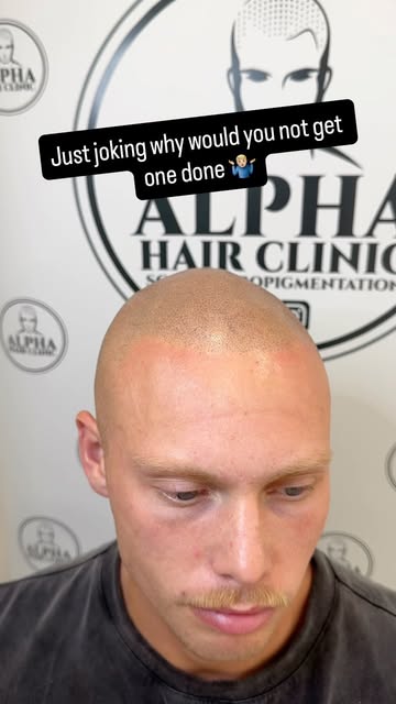 Just a few of the awesome jobs coming out of our hair clinic this week 🔥

If you’re looking into SM