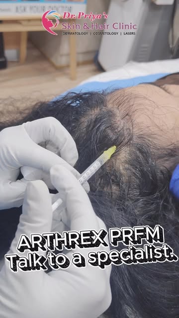 ✨ Refresh. Repair. Rejuvenate.

PRFM is an advanced regenerative treatment that uses your own blood-