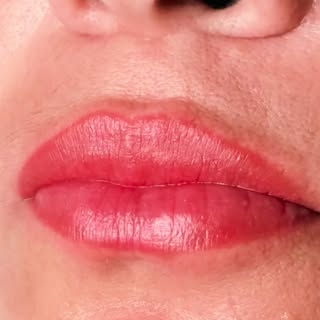 ✨ No todos los labios tienen un tono uniforme.

Algunas personas presentan zonas más oscuras, violác
