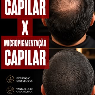 Micropigmentação Capilar Fio a Fio + Pós-Transplante Capilar 

O transplante capilar devolve os fios