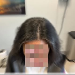 From thinning to thriving— midweek motivation!

This patient first came to Dr. Kim at our Center for