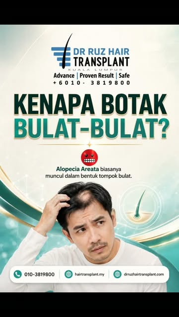 KENAPA BOTAK BULAT-BULAT? 👀
Kalau anda perasan satu kawasan rambut tiba-tiba kelihatan kosong dalam