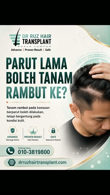 Parut lama. Rambut tak tumbuh. Tapi… masih boleh tanam rambut ke? 👀
Ramai yang ada parut di kulit k