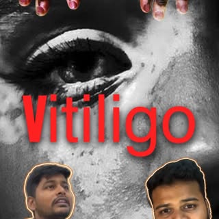 The darkest side of India - Vitiligo 

In India if the family member has this disease, why people ar