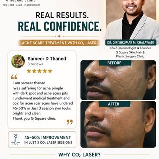 ✨ Real Results. Real Confidence. ✨

Acne scars don’t disappear overnight—but with the right diagnosi