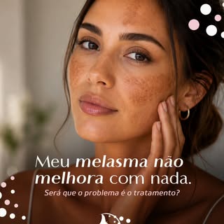 “Já tentei de tudo e meu melasma não melhora”.

Essa é uma queixa muito comum e nem sempre significa