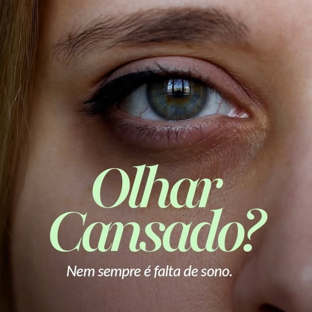As olheiras escuras costumam incomodar muitas pessoas, mas, por ser uma região delicada, nem todo pr