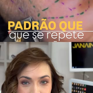 Padrão que se repete aqui na clínica! 

#transplant #capilar #dermatologia #medicina