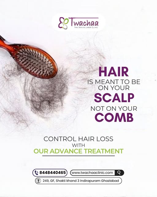 Hair belongs on your scalp—not on your comb. ✨

Excessive hair fall can be frustrating, but with the
