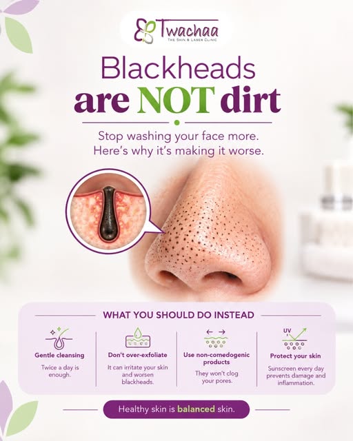 🖤 Blackheads are NOT dirt!

Over-washing or aggressively scrubbing your face won't necessarily get 