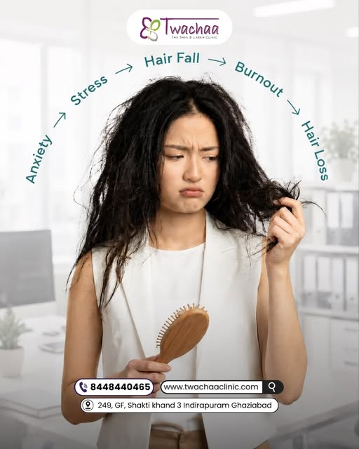 Hair fall can be more than just a bad hair day. 💇‍♀️
Stress, burnout, anxiety and lifestyle changes