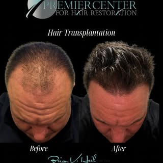 Real patients. Real results. 🤩

This transformation is INCREDIBLE! It’s so rewarding to see the dif
