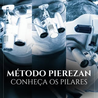 O que é o Método Pierezan no transplante capilar? 
💎 É a união de 3 pilares que garantem resultados
