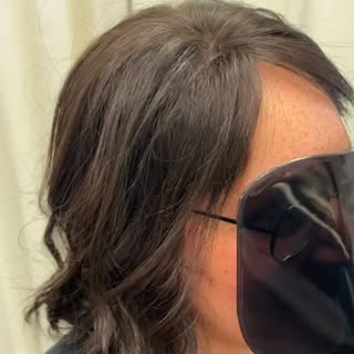 No one prepares you for the moment your scalp starts showing up more in photos than your hair does.
