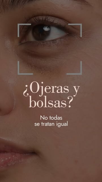 👀 ¿Por qué tus ojeras no desaparecen aunque uses contorno de ojos todos los días?

Porque no todas 