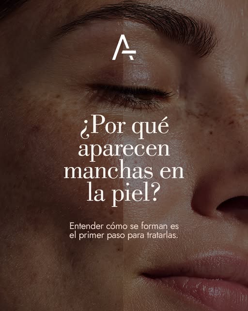 Esas manchas que intentas tapar con maquillaje tiene una historia. 

Y entenderla es la clave para t