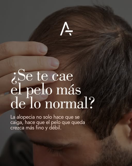 La pérdida del cabello genera angustia, y muchas veces se enfrenta tarde o con soluciones rápidas qu