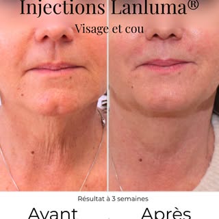 ✨ Et si la plus belle des transformations était celle que l'on ne remarque pas immédiatement... mais