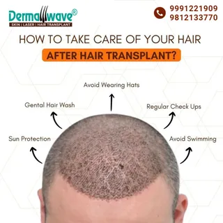 🌟 No More Baldness – Get Your Confidence Back! 🌟
Hair thinning or bald patches making you look old