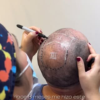 Nos encantan los testimonios de nuestros pacientes! Sobretodo cuando tienen la posibilidad de volver