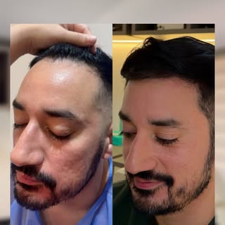 Our patient Tony tells us about his experience having surgery with us! We are so happy to recieve al