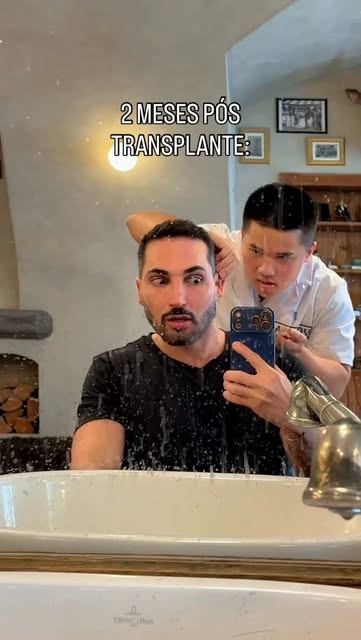 60 dias exatos do transplante com o @drjoaopedrocpereira 
O que estão achando?