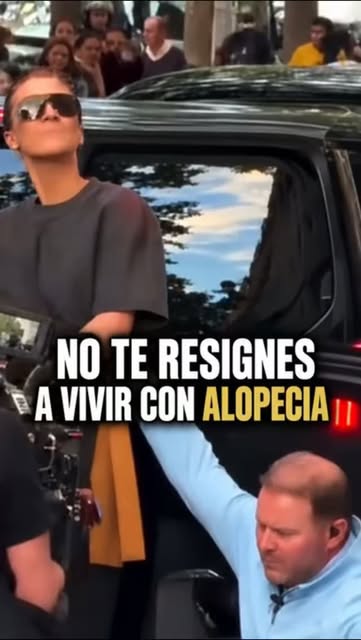 La alopecia no tiene por qué ser algo a lo que simplemente tengas que resignarte.

Hoy existen difer
