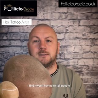 Scalp Micropigmentation offers life changing results every time. It's the only guaranteed hairloss s