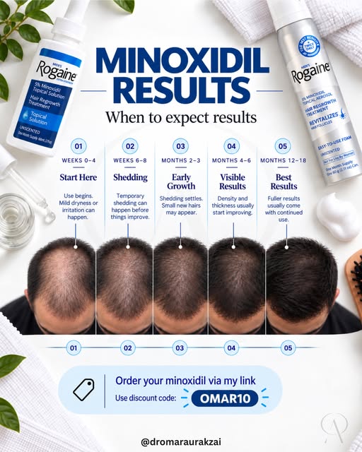 Minoxidil results take time — and knowing the timeline can make it much easier to stay consistent.

