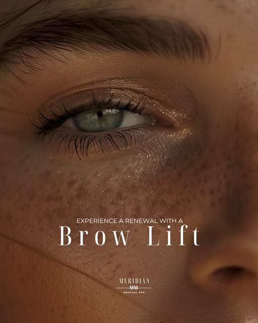 Come see why a brow lift is a fan favorite ❤️
