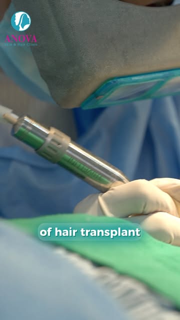 Are you scared of scaring due to hair transplant?

For Your Skin/Hair Consultation :
​🔍 Anova Skin 
