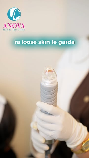 are you suffering from acne scar, large pores and loose skin?

For Your Skin/Hair Consultation :

🔍