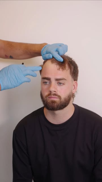 Hoe bepalen we de juiste haarlijn?

Bij het bepalen van de haarlijn kijken we zorgvuldig naar de hoo