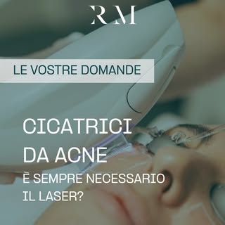 Spesso mi chiedete:
“Per trattare le cicatrici da acne è sempre necessario il laser?”
La risposta è 