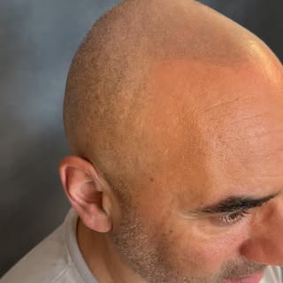Booomm 💣 💣 💣 ein kleiner Einblick was ein natürlicher shavelook für einen unterschied macht 🙋🏻‍