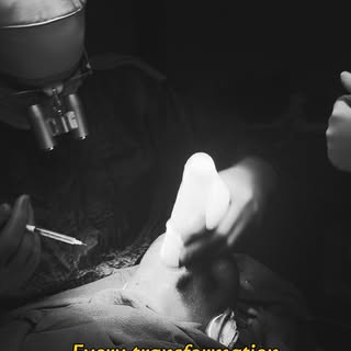 A successful hair transplant is not just about placing grafts — it is about careful planning, surgic