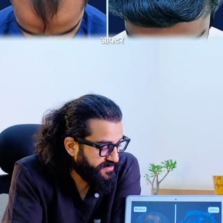Hair loss is not just about losing hair — for many people, it can affect confidence, appearance, and