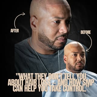 What they don’t tell you about hair loss…

It’s not just about your hairline — it’s about your confi