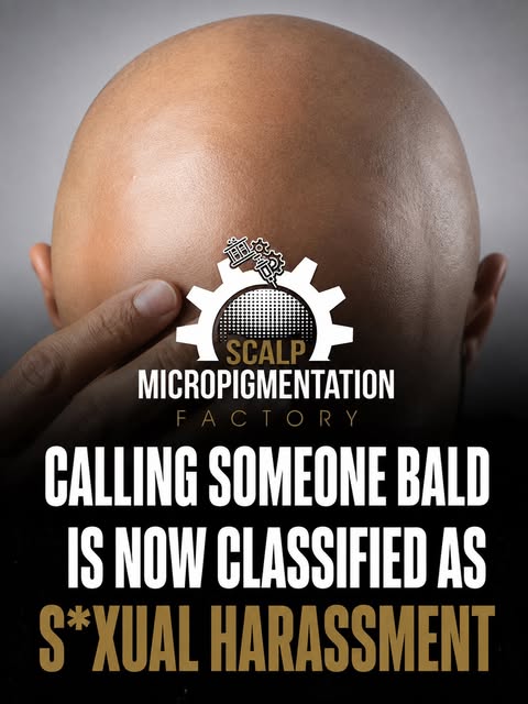 🚨 Apparently calling someone “bald” can get you in trouble now 😂

Good news… The SMP Factory is he